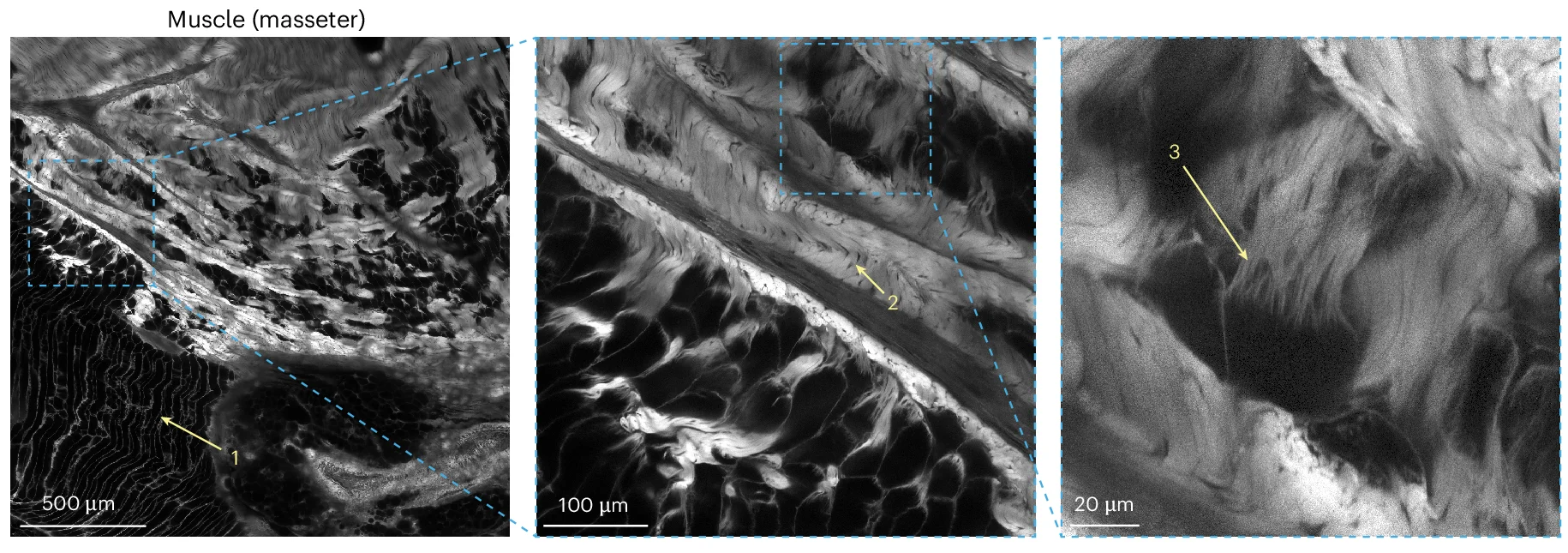 Open access visualization of Microscopy, 2P Image, Muscle Tissue, ECM Features, Rhobo6 Labeling