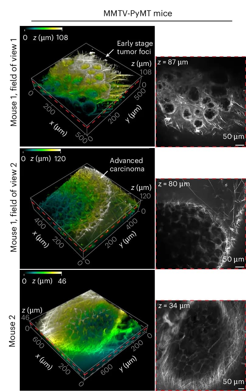 Open access visualization of 3D Plot, Microscopy, MMTV-PyMT Mice, Early-Stage Carcinomas, Late-Stage Carcinomas