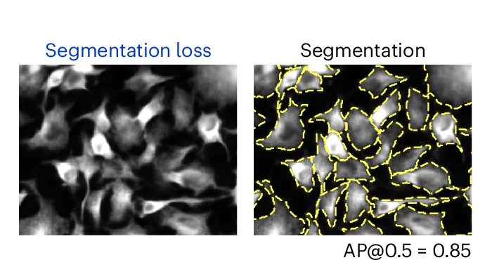 Open access visualization of Microscopy, Denoised Images, Segmentation, Losses, Network