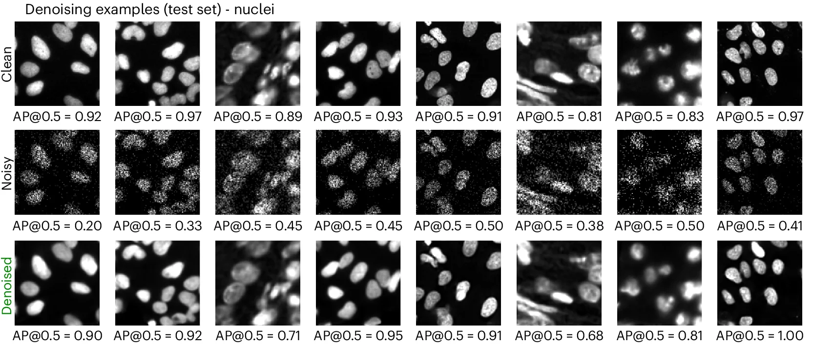Open access visualization of Microscopy, Ground Truth, Poisson Noise, Denoised Image, Nuclei