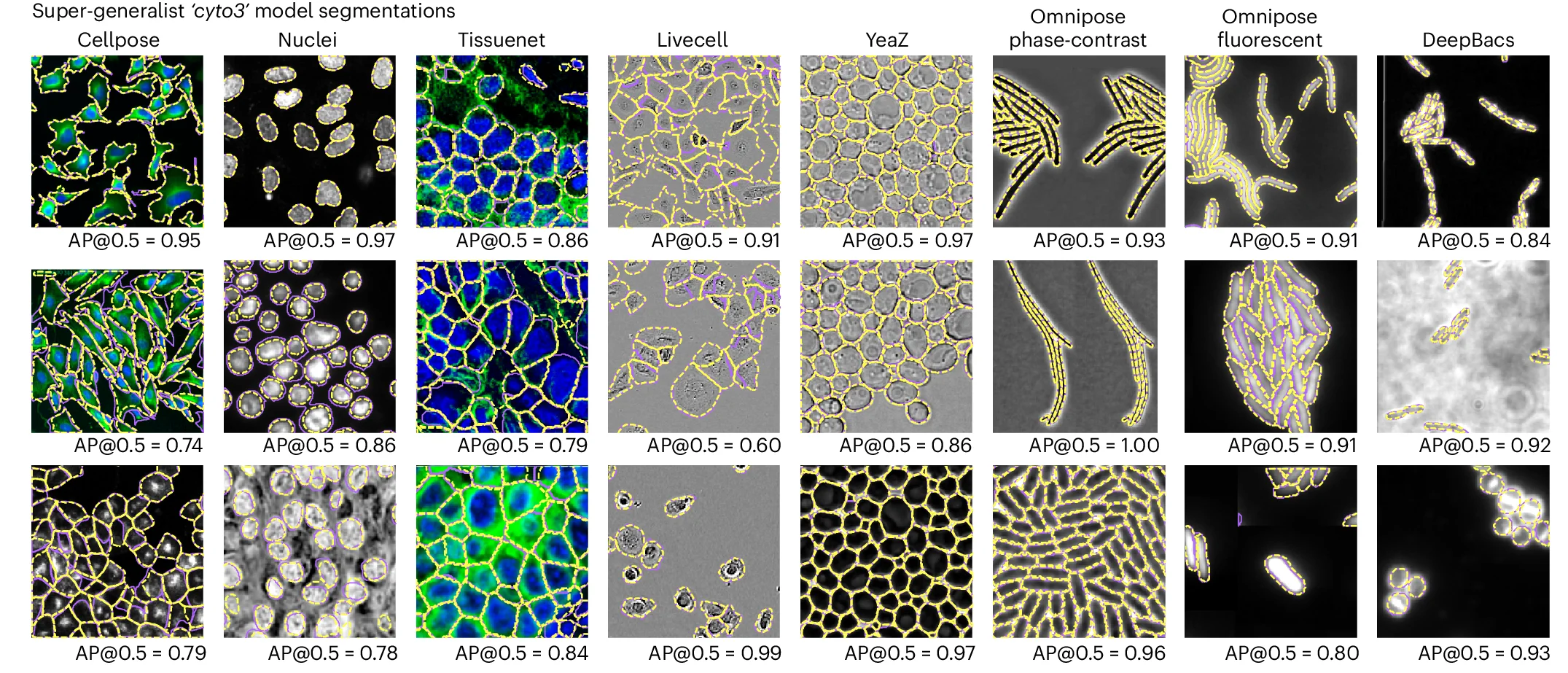 Open access visualization of Microscopy, Images, Segmentation, Ground Truth, Model Segmentation