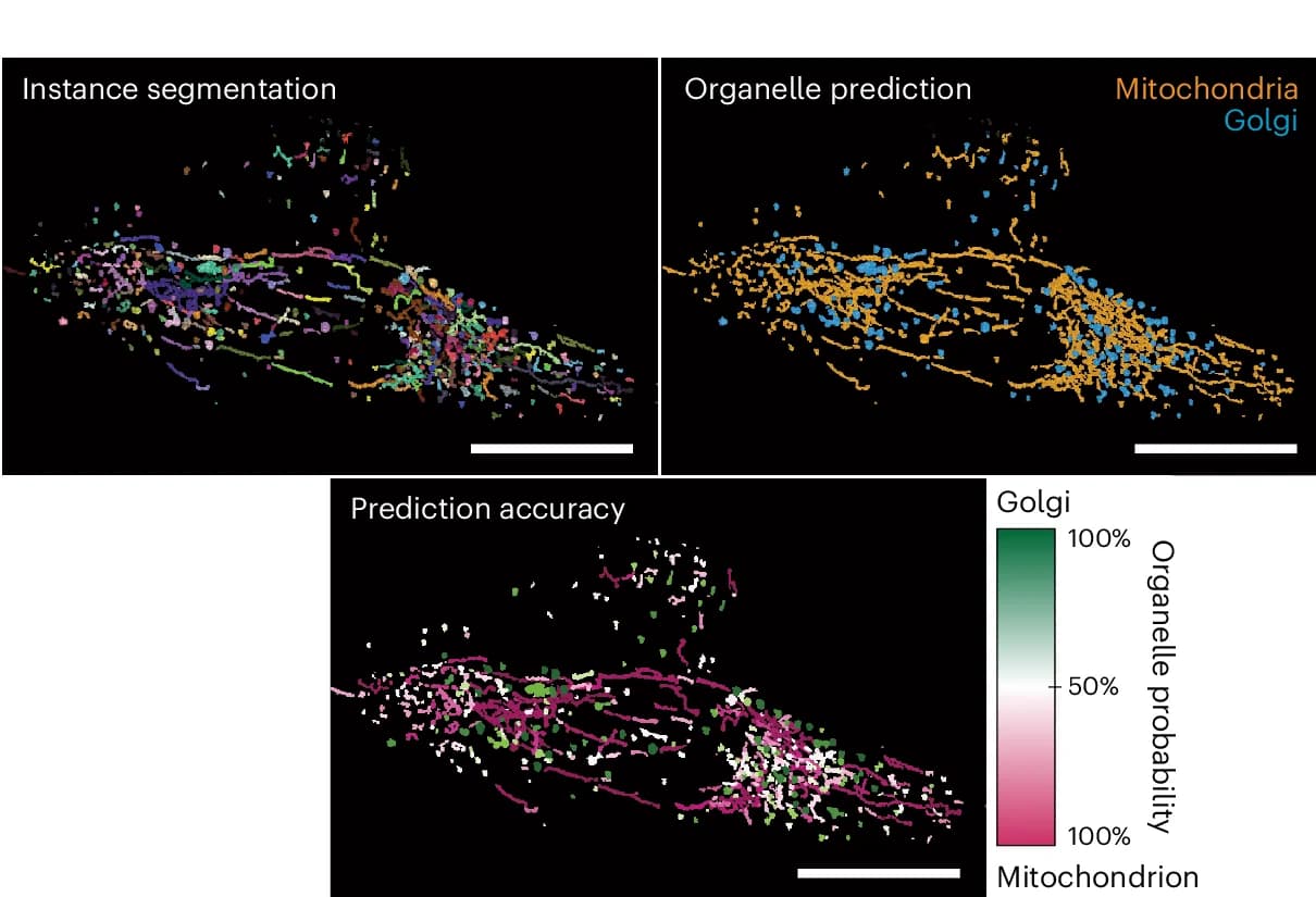 Open access visualization of Microscopy, Instance Segmentation, Organelle Prediction, Random Forest Classifier, Probability