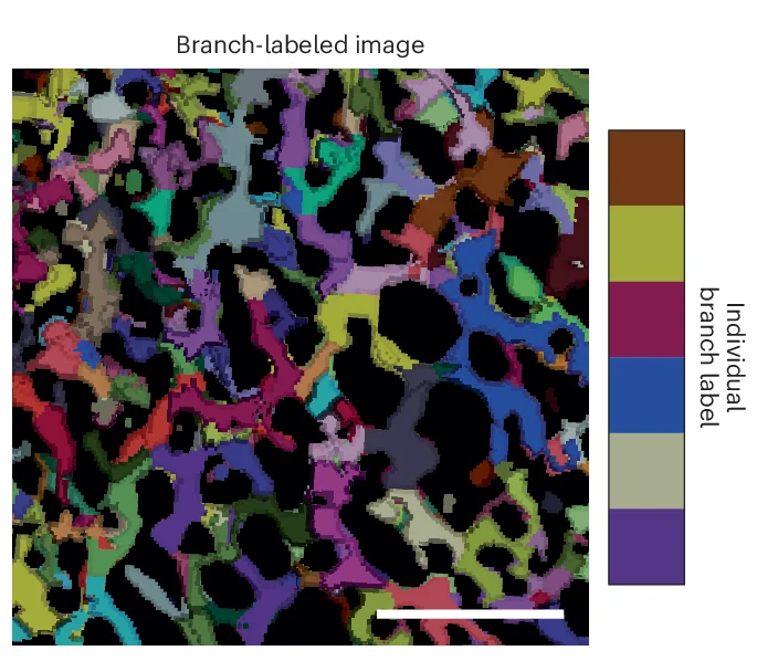Open access visualization of Microscopy, Instance Segmentation, ER Branches