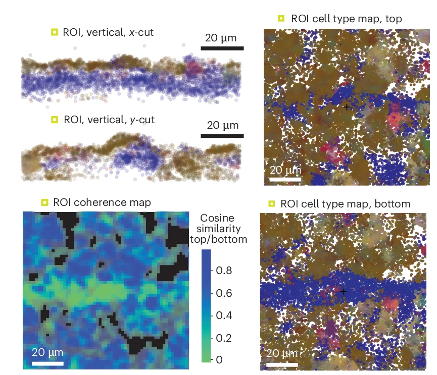 Open access visualization of Scatter Plot, Heatmap, Spatial Maps, 3D Coherence, Xenium Datasets