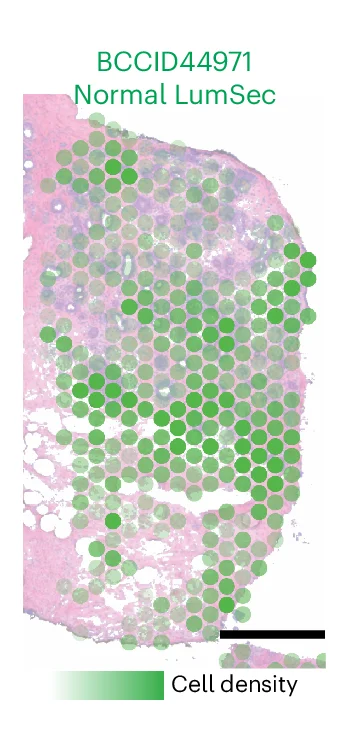 Open access visualization of Microscopy, Scatter Plot, Bubble Plot, Transcriptomic Spots, Visium Data