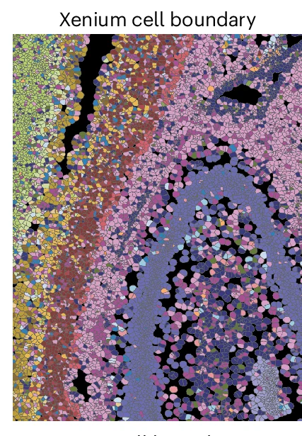 Open access visualization of Microscopy, Cell Type, Cell Boundaries, Xenium, Spotiphy