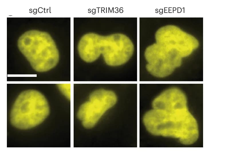 Open access visualization of Microscopy, Nuclei Images, Control, Hits, Nuclear Sphericity