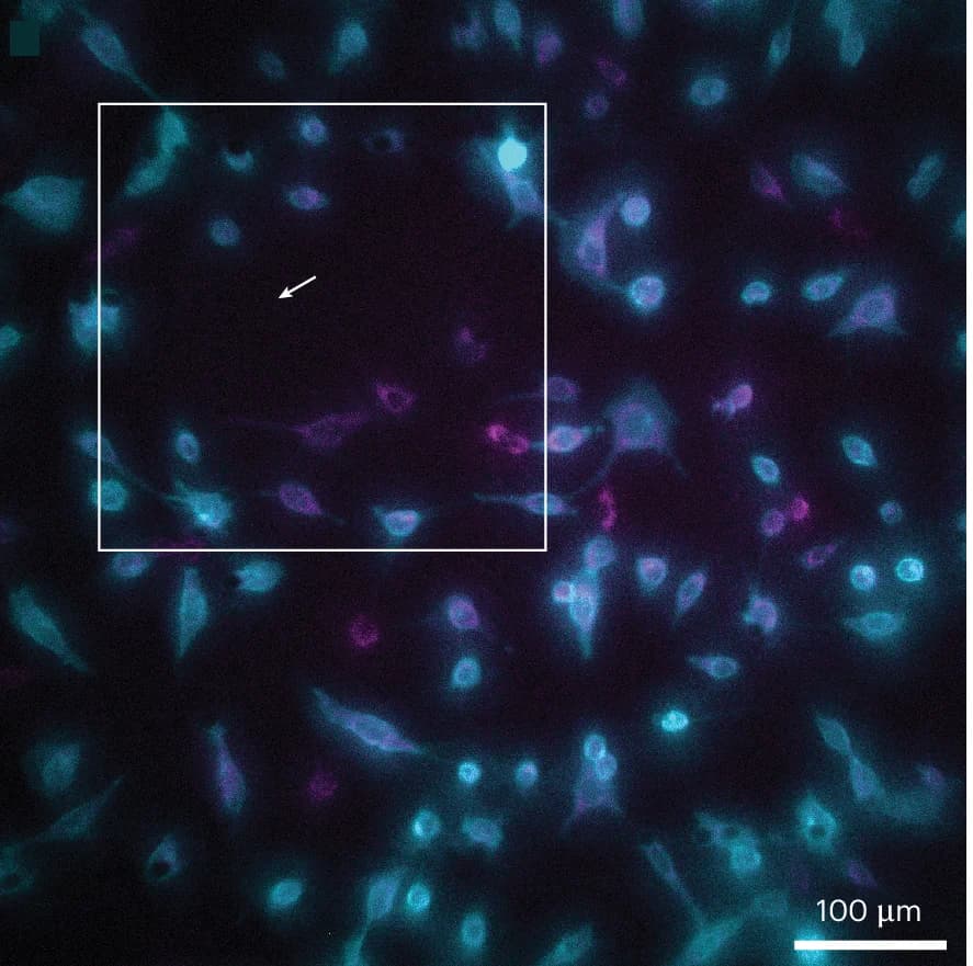 Open access visualization of Microscopy, Bioluminescence, Fluorescence, NLuc-CD63, MitoTracker Red CMXRos