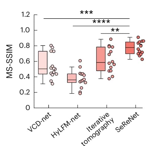 Open access visualization of Box Plot, Scatter Plot, Boxplot, MS-SSIM Indices, Ground Truth