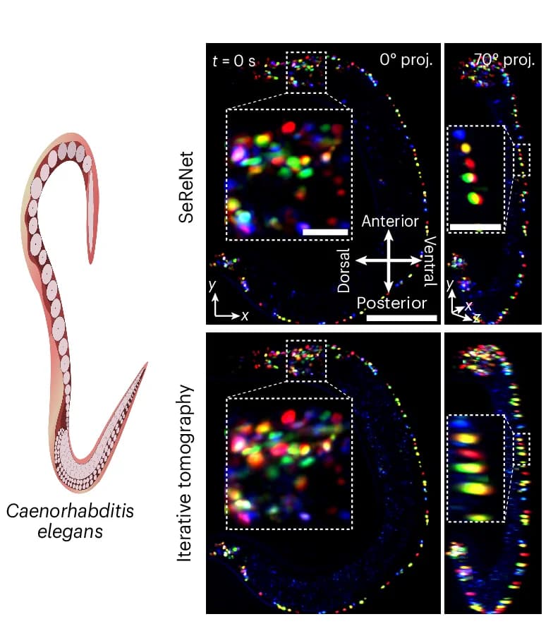 Open access visualization of Microscopy, Photo, Dual-Directional Maximum Intensity Projections, NeuroPAL Worm, SeReNet