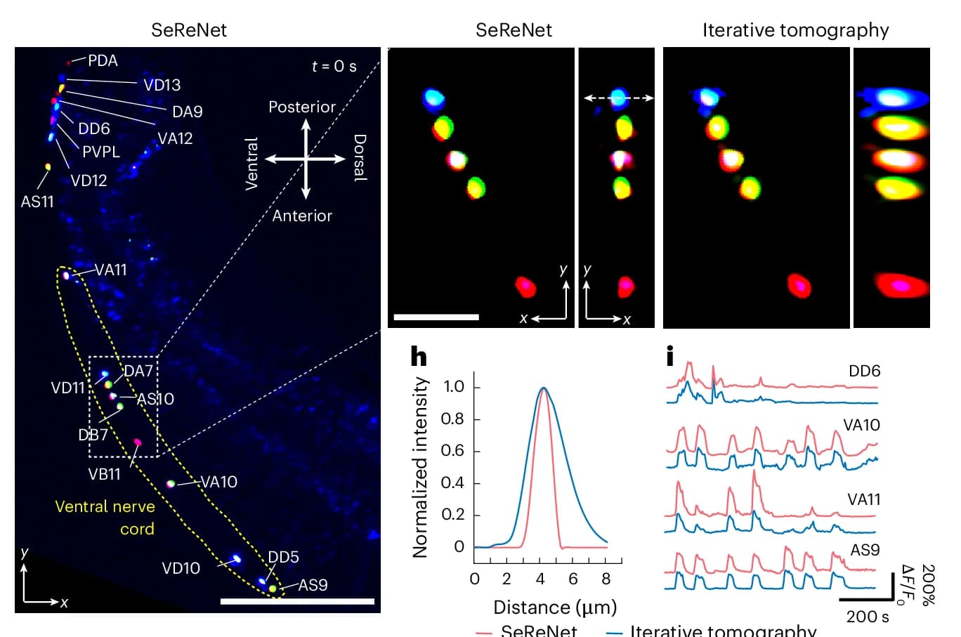 Open access visualization of Microscopy, Line Plot, Orthogonal Maximum Intensity Projections, Neuron-Labeled Worm, SeReNet
