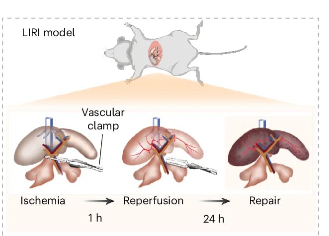 Open access visualization of Workflow, Illustration, LIRI Model, Hepatic Ischemia, Reperfusion