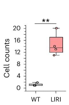 Open access visualization of Box Plot, Scatter Plot, Neutrophil Count, Mouse Livers, LIRI