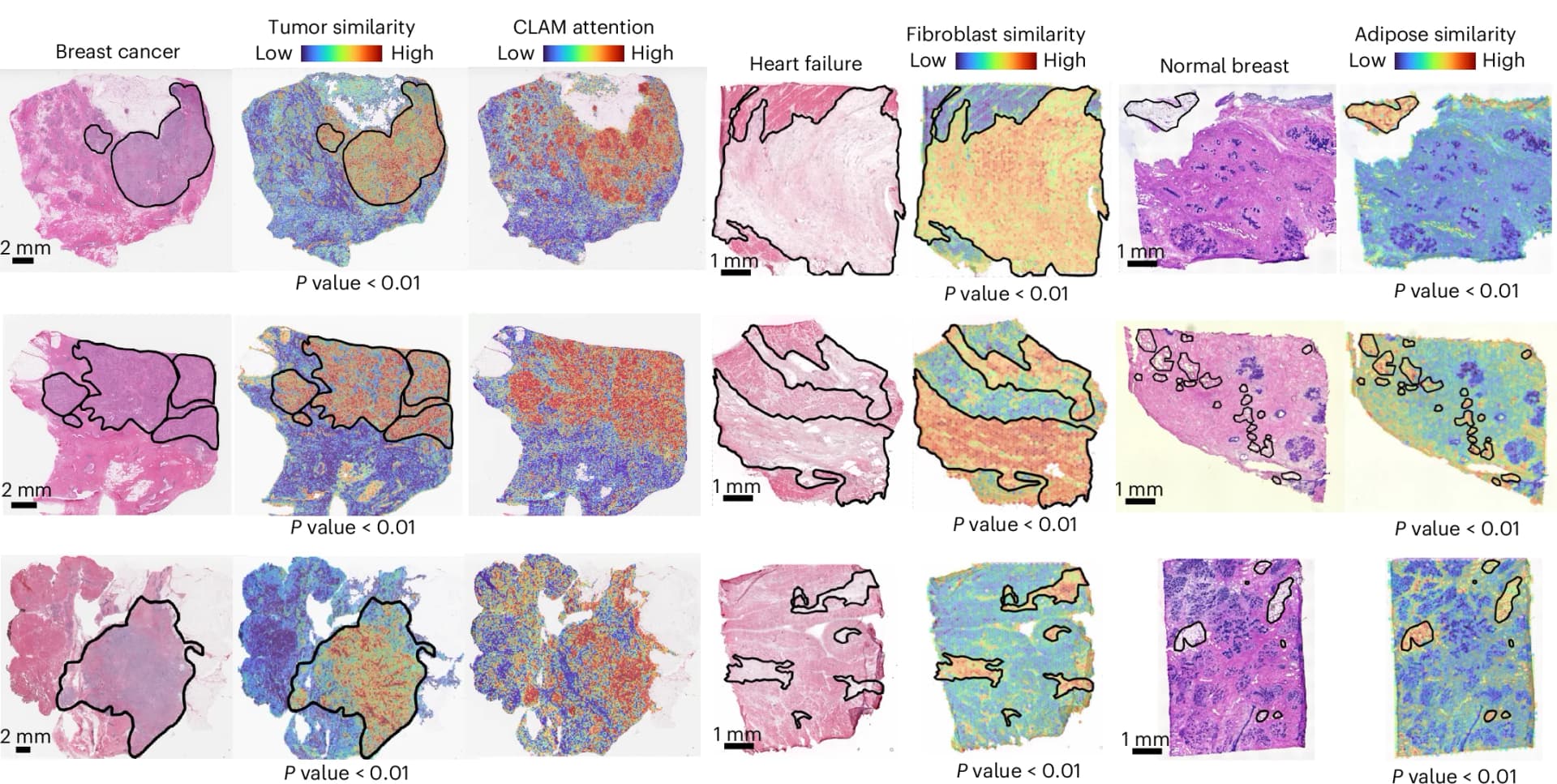 Open access visualization of Microscopy, Histology WSIs, Breast Cancer, Heart Failure, Normal Breast Samples