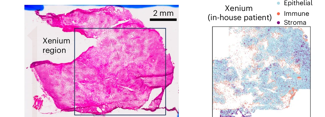 Open access visualization of Microscopy, Scatter Plot, H&E Image, TNBC Sample, Cancer Epithelial Cells