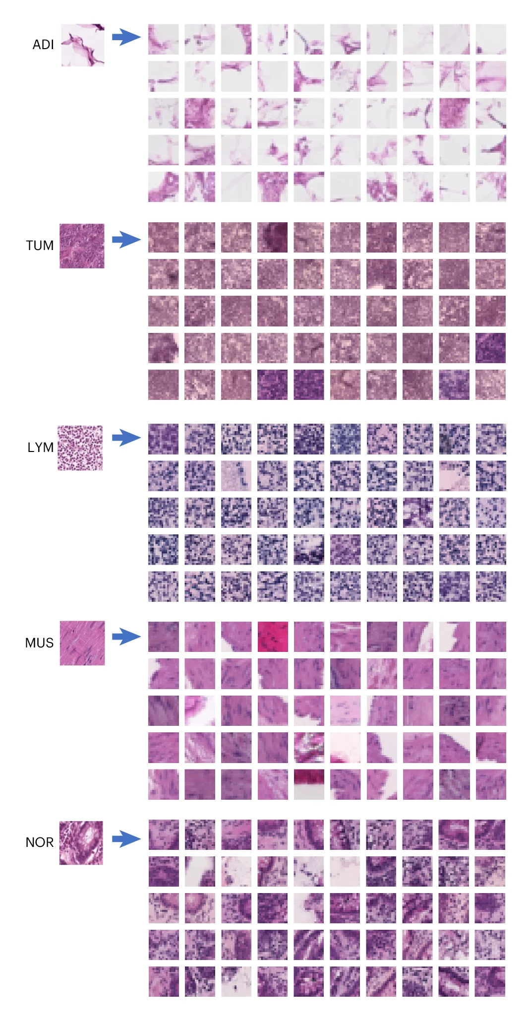 Open access visualization of Microscopy, Image-to-Transcriptomics Retrieval, Adipose Tissue, Colorectal Adenocarcinoma Epithelium, Lymphocytes