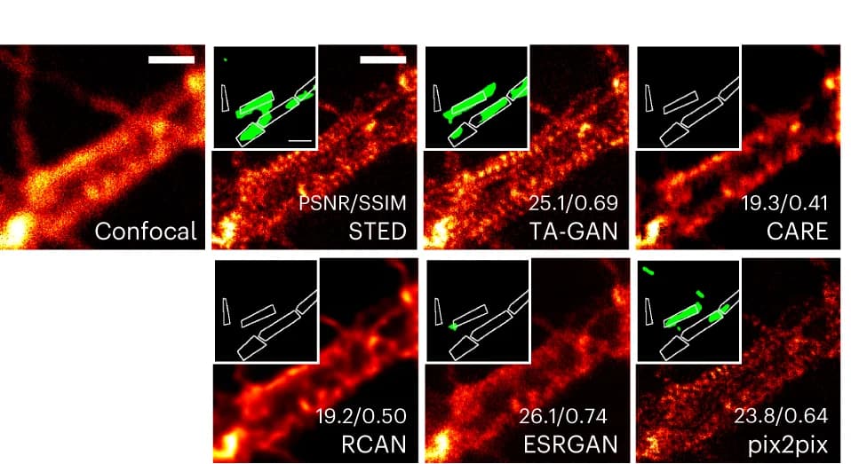 Open access visualization of Microscopy, TA-GAN Ax, Super-resolution, Axonal F-actin dataset, Confocal image