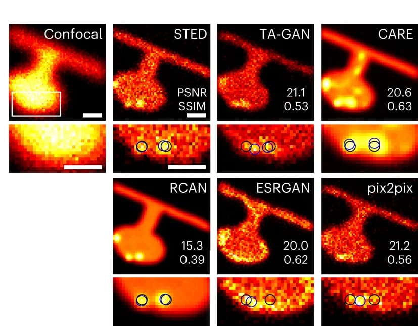 Open access visualization of Microscopy, TA-GAN Nano, Nanodomain localization, Nanodomains