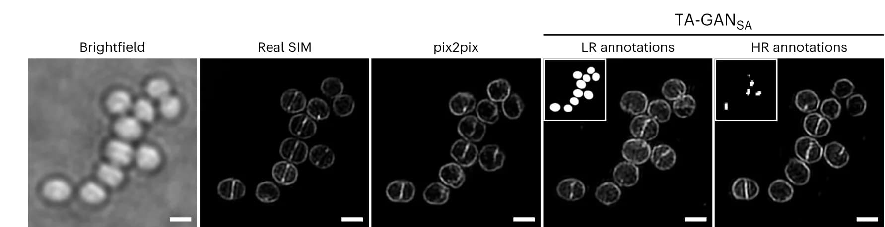 Open access visualization of Microscopy, S. aureus Dataset, pix2pix, TA-GAN SA, LR Annotations
