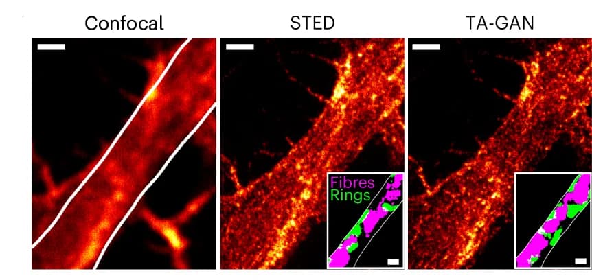 Open access visualization of Microscopy, Confocal, Real STED, TA-GAN Dend, Synthetic Images
