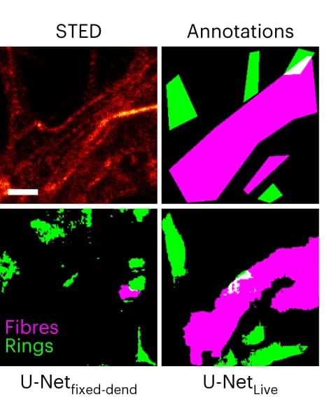 Open access visualization of Microscopy, Live-Cell STED Images, F-actin Nanostructures, U-Net Fixed-Dend, U-Net Live