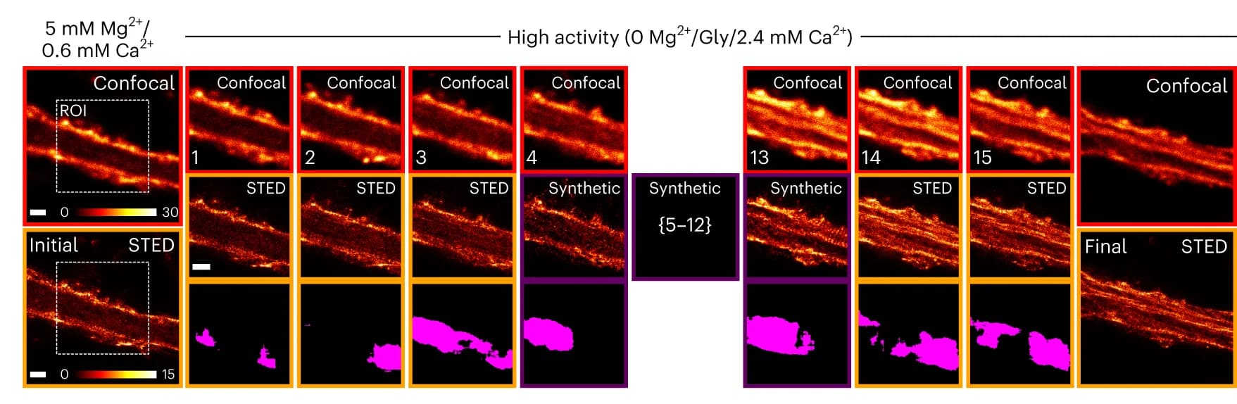 Open access visualization of Microscopy, Live-cell imaging, Dendritic F-actin, Confocal, Synthetic STED