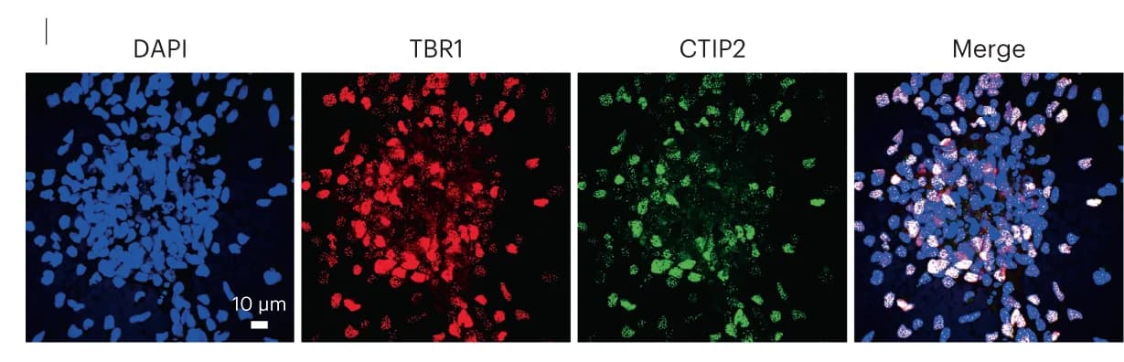 Open access visualization of Microscopy, TBR1, CTIP2, Cortical Layers