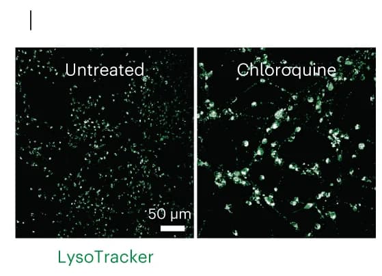 Open access visualization of Microscopy, High-Throughput Imaging, Lysosomal Dysfunction, Chloroquine
