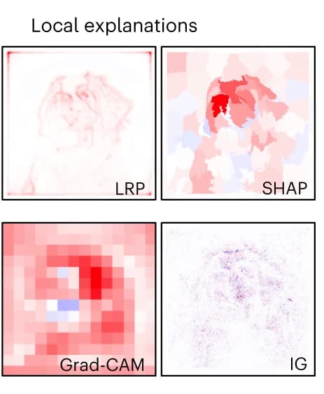 Open access visualization of Heatmap, Attribution Maps, LRP, SHAP, Grad-CAM