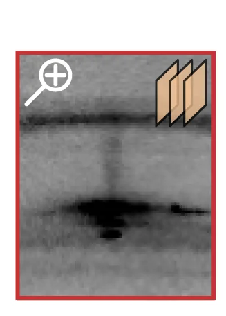 Open access visualization of Gel, LC Frame, Zoom, Denoising, IRUNet Network