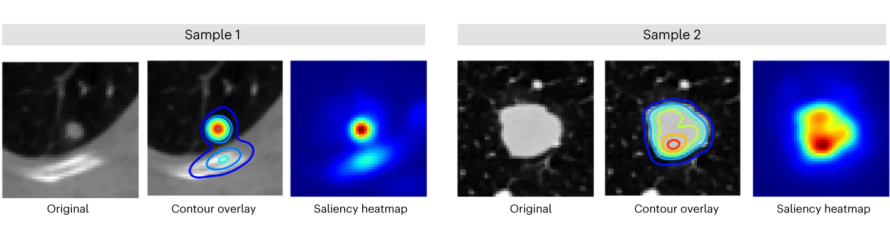 Open access visualization of Microscopy, Heatmap, Saliency Maps, Foundation Models, Smooth Guided Back-propagation
