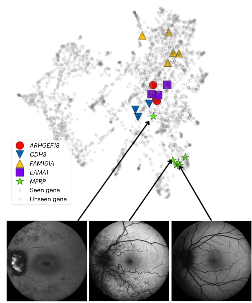 Open access visualization of Scatter Plot, UMAP, Microscopy, Eye2Gene, Gene