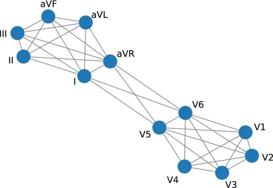 Open access visualization of Network, Pathway, ECG data, Signal channels, Leads