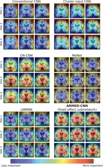 Open access visualization of Heatmap, Grad-CAM, Alzheimers Disease, Cognitively Normal Individuals, Image Regions