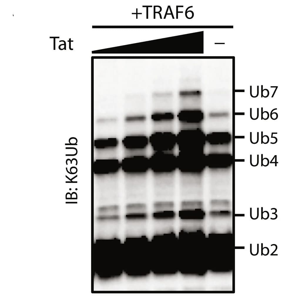Open access visualization of Gel, NF-B Activation, Tat, TRAF6 E3 Ligase