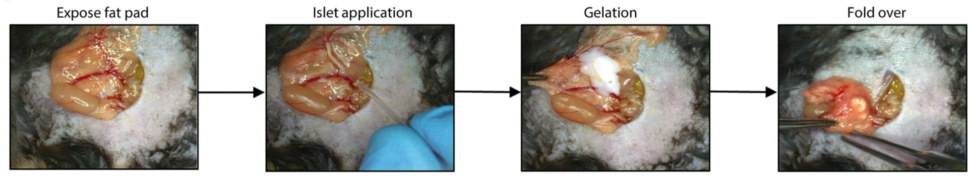 Open access visualization of Workflow, Photo, PPCN, Islets, Transplantation