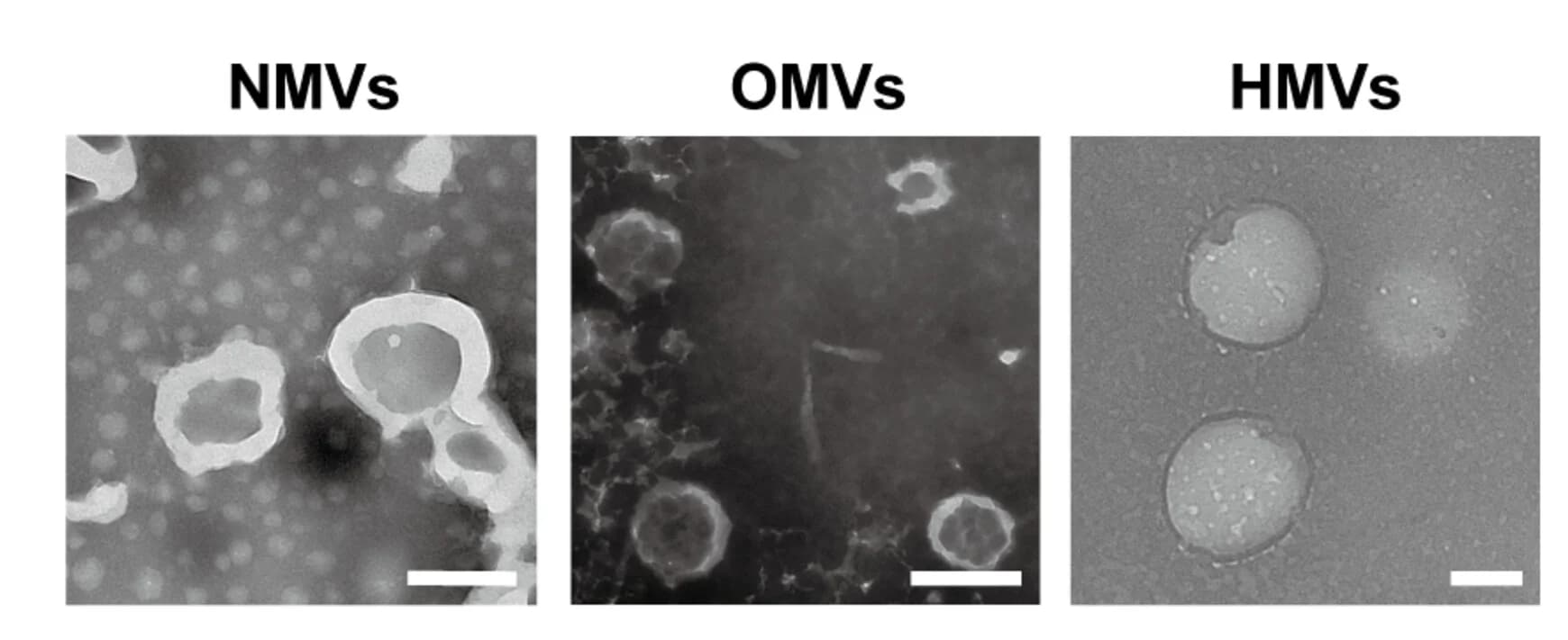 Open access visualization of Microscopy, HMVs, LNP-N@HMVs