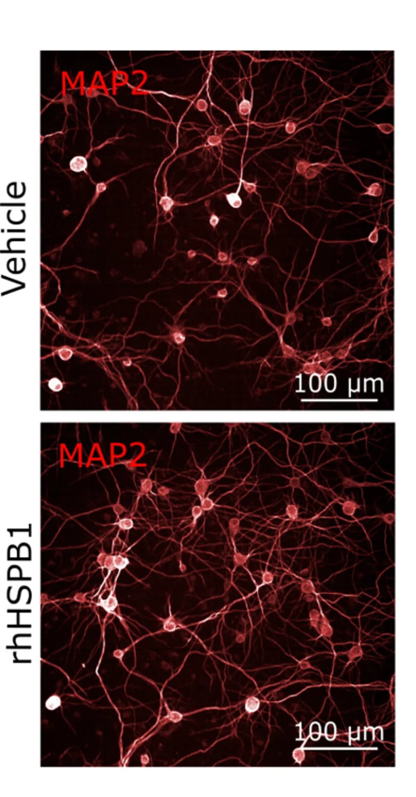 Open access visualization of Microscopy, Extracellular hHSPB1, Neuronal Health, Mutant Tau, Mouse Neurons