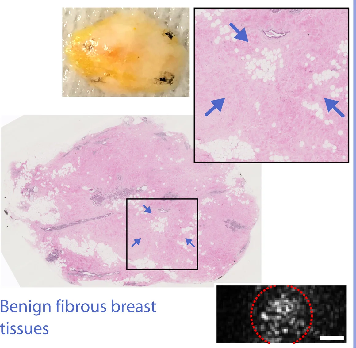 Open access visualization of Microscopy, Photo, Viscoelastic Spectra, Breast Tumor, Microenvironment