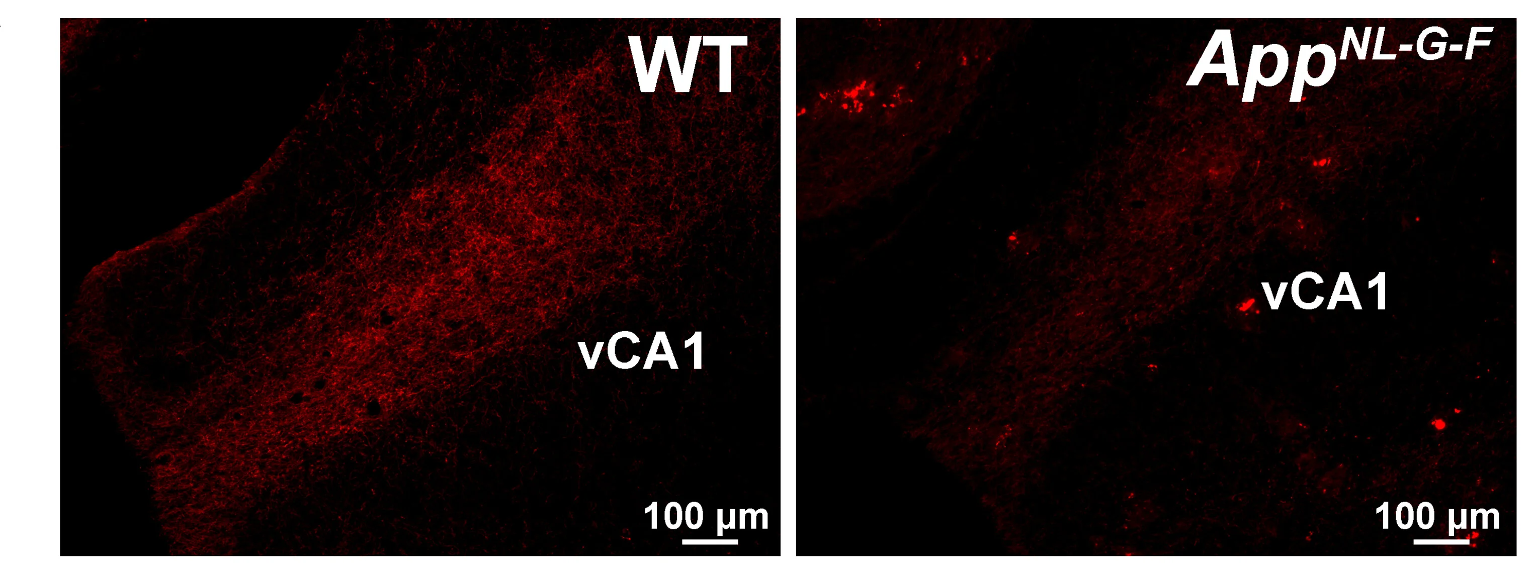 Open access visualization of Microscopy, 5-HT 2C R Agonist, vCA1 Neural Plasticity, Memory, App NL-G-F Mice