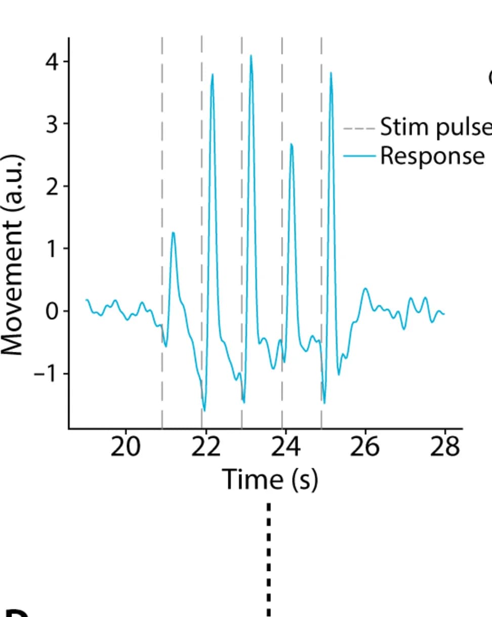 Open access visualization of Line Plot, Line Step, Epidural Cortical Stimulation, Battery-Free Device, Intraoperative