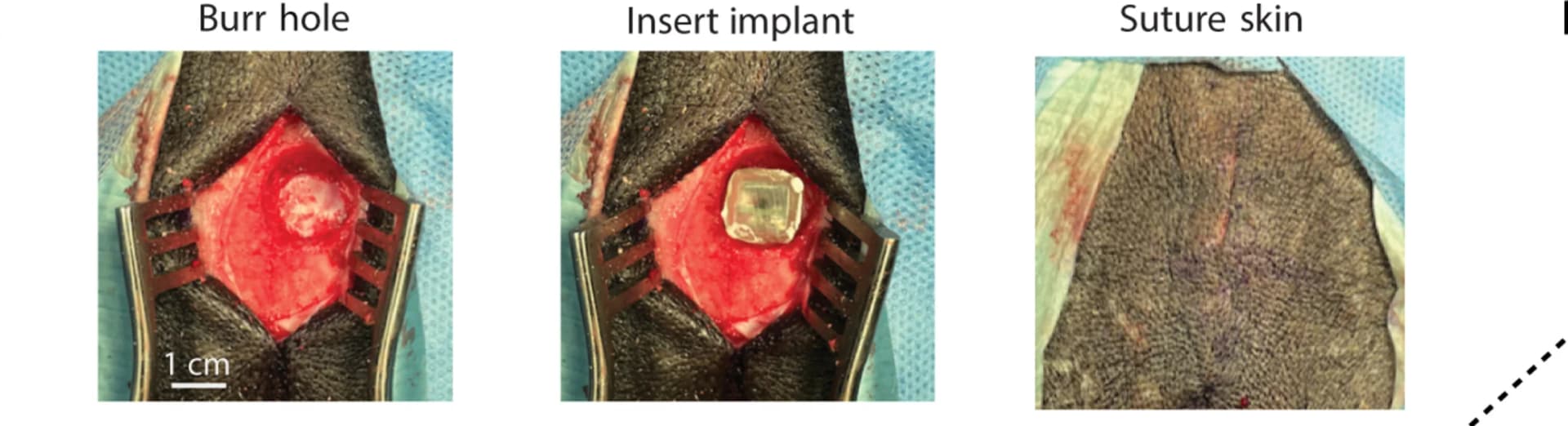 Open access visualization of Photo, Epidural Cortical Stimulation, Animal Model