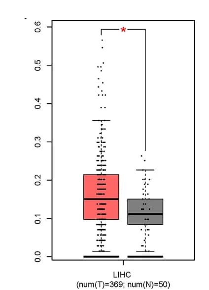Open access visualization of Box Plot, Scatter Plot, GEPIA Database, AL133243.2