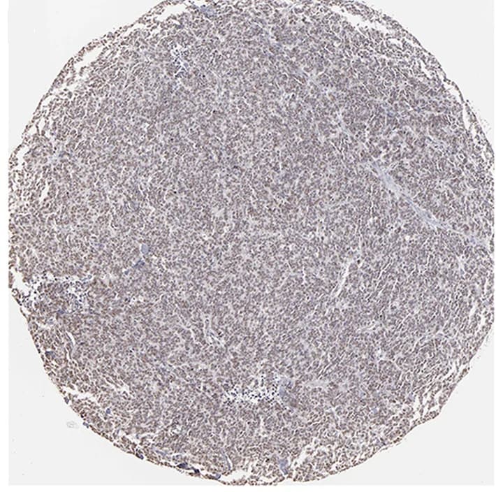 Open access visualization of Microscopy, Immunohistochemistry, NFE2, LUAD