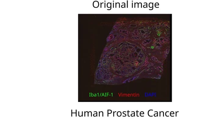 Open access visualization of Microscopy, Immunofluorescence, Iba1/AIF-1, Vimentin, DAPI