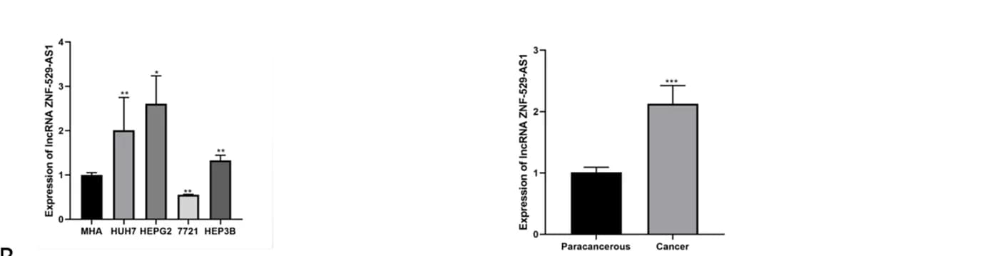 Open access visualization of Bar Plot, Error Bars, qPCR, Hepatocellular Carcinoma Cells, Tissue