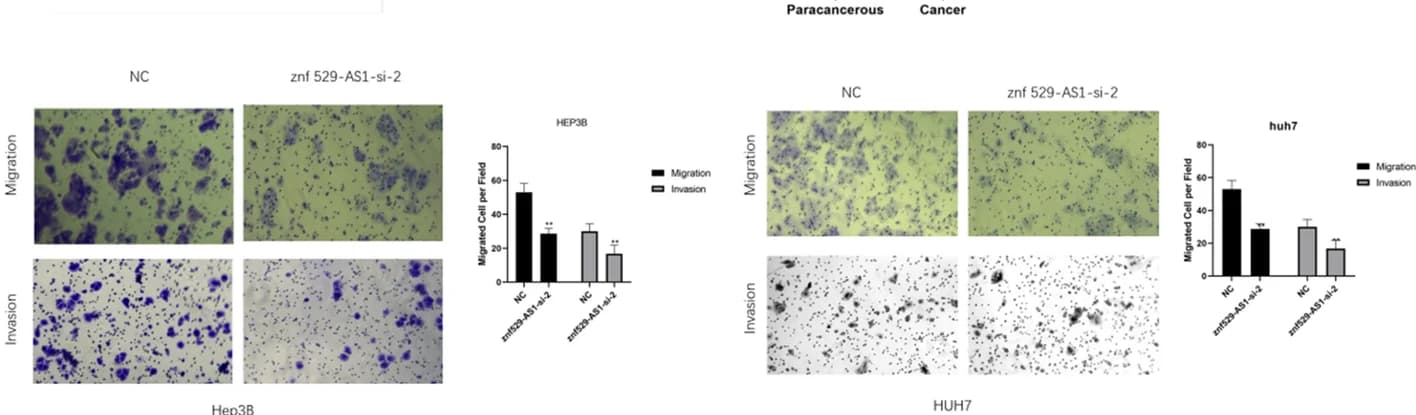 Open access visualization of Photo, Bar Plot, Microscopy, Transwell Assay, Invasion
