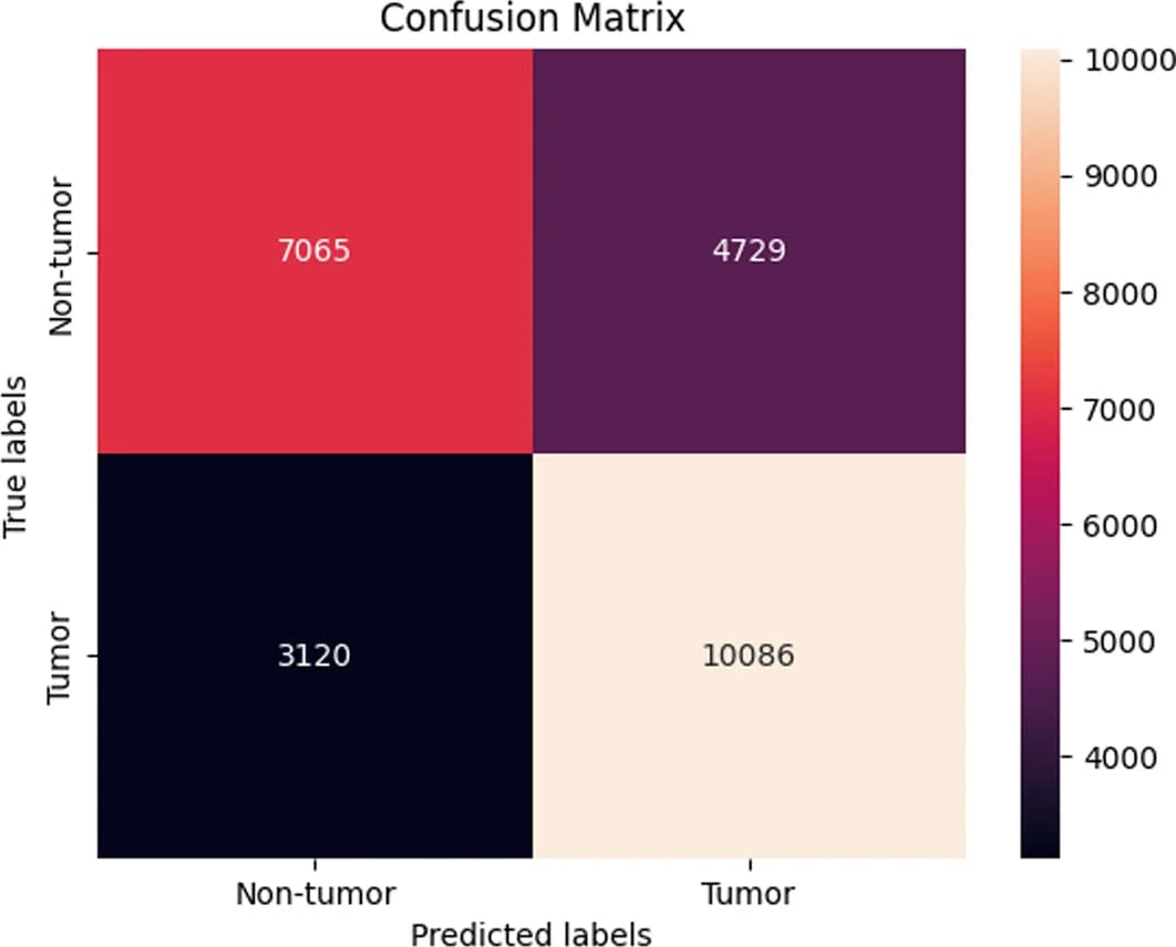 Open access visualization of Heatmap, XGBoost Model, SBERT Representations, SMOTE, Confusion Matrix