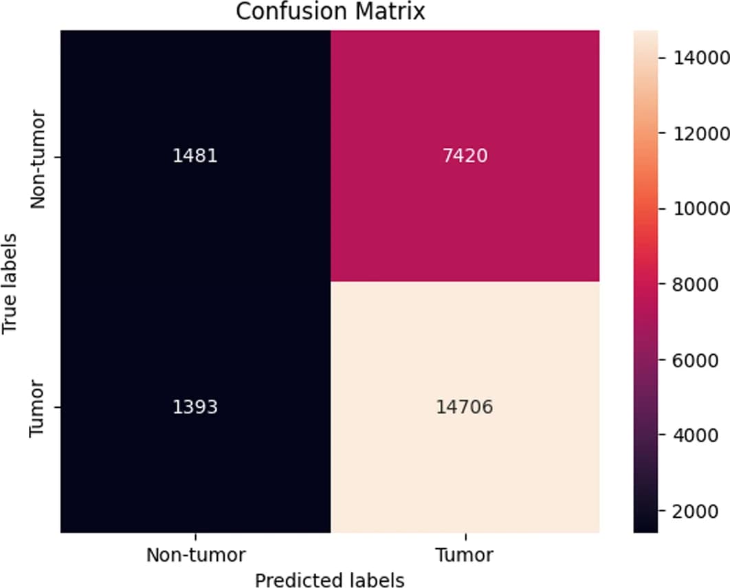 Open access visualization of Heatmap, LightGBM Model, SimCSE Representations, SMOTE, Confusion Matrix