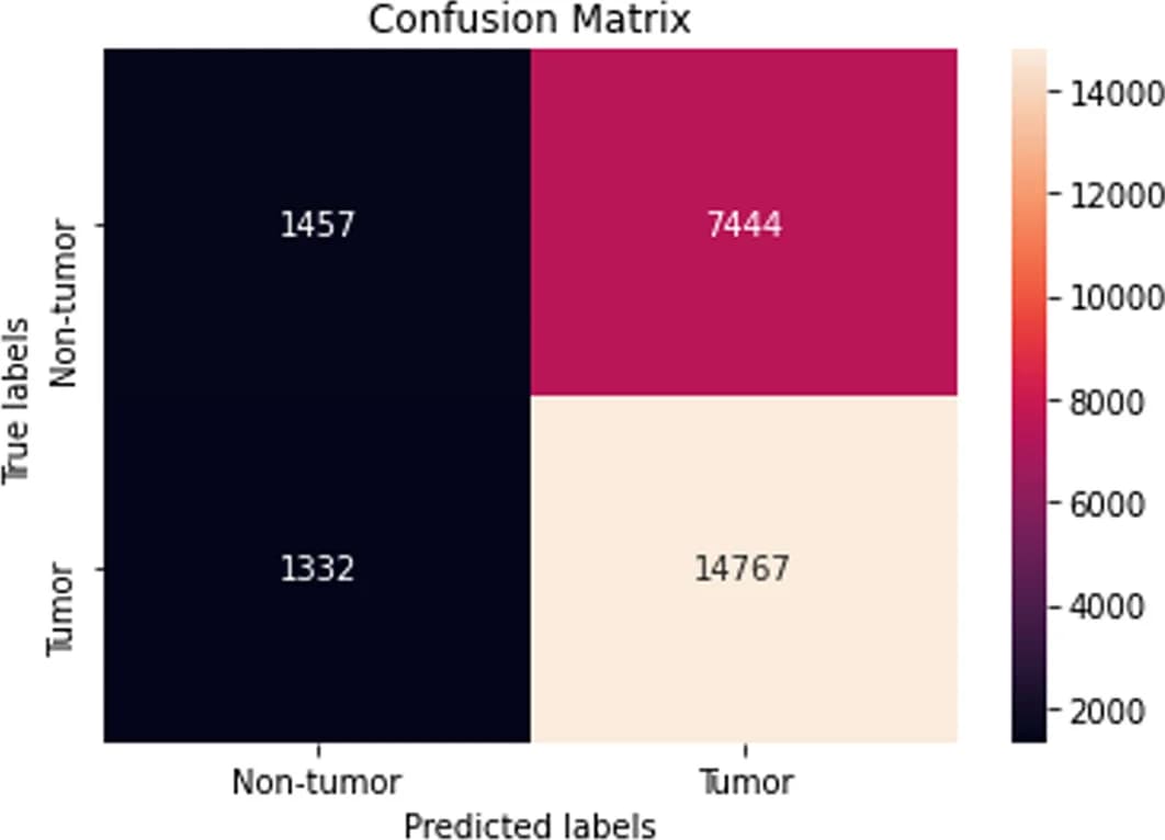 Open access visualization of Heatmap, LightGBM, SBERT, SMOTE, Confusion Matrix